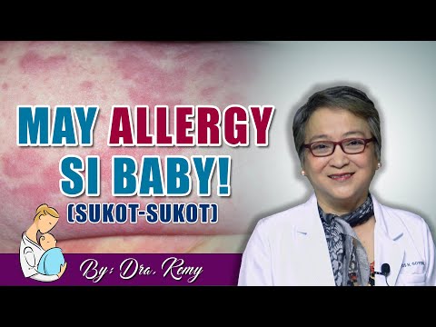 Video: Ano Ang Hitsura Ng Allergy Sa Mga Sanggol?