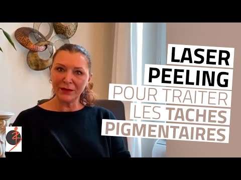 Vidéo: Le Meilleur Laser Pour Les Taches