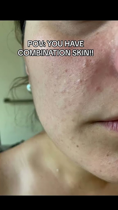 Do you have COMBINATION SKIN?! #skincare #skincareroutine