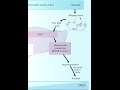 Diabetic Ketoacidosis (DKA)