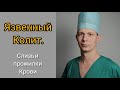 Слизь, прожилки крови в кале  м.б. симптомом опасных болезней, например, Язвенного колита. Смотрим.