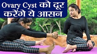 Yoga: Ovary Cyst की समस्या को दूर करेंगे ये आसन |  वनइंडिया हिंदी screenshot 1