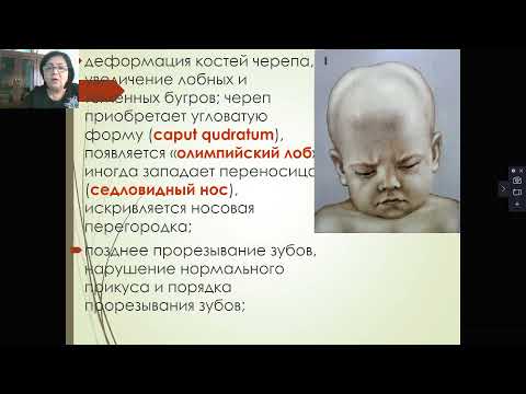 Анатомо физиологические особенности костно мышечной системы у детей  Семиотика поражения