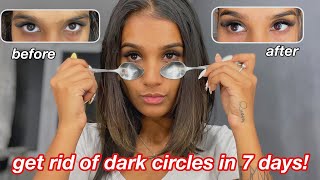 How I Got Rid Of My Dark Circles In 7 Days!! || Works 100%