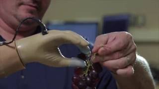 Prosthetic Hand Restores Amputee's Sense of Touch
