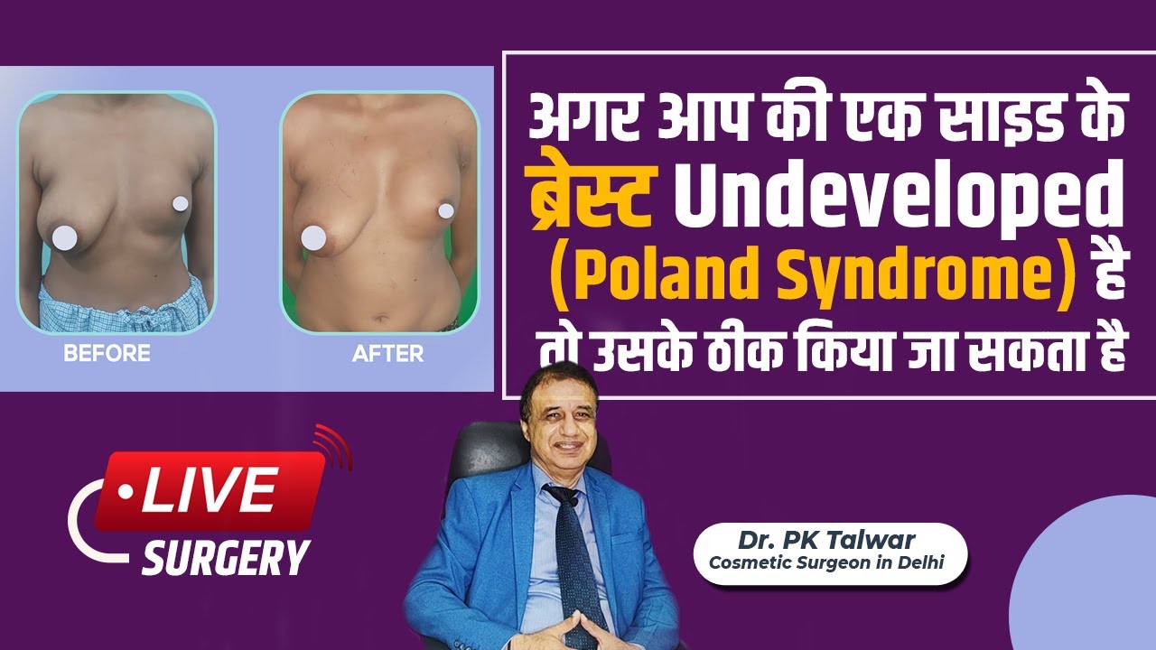 लाइव सर्जरी - Uneven Breasts या Underdeveloped Breasts