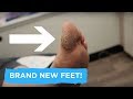 BRAND NEW FEET - CALLUS AND NAIL CARE!