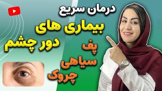 در 2 هفته سیاهی، پف زیر چشم و چروک های پنجه کلاغی دور چشمت رو برطرف کن! | آموزش ماسک خانگی دور چشم