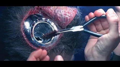 First Aid Operation Brain Chip- Terminator 2 Judgement Day (1991) - Movie Clip 4K HD Scene