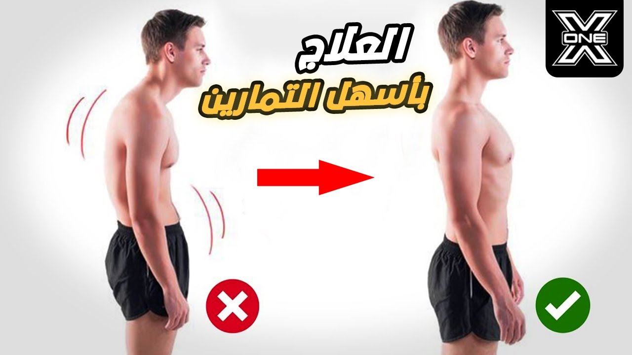 أسهل تمارين لعلاج انحناء وتقوس الظهر والأكتاف !!