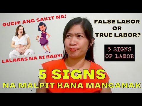 Video: Paano I-undo Ang Isang Malapit