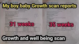 My baby boy growth & well being scan//7th & 9th month scan//pregnancy tips//nandinisharathmysuru.