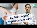 വീട്ടിലിരുന്ന് എങ്ങനെ മുറിവ് കെട്ടാം | How to do Wound Dressing at Home | Malayalam | Doctor prasoon