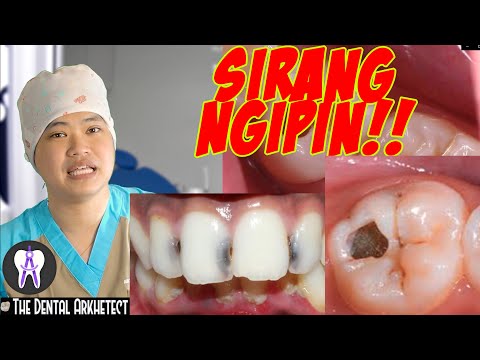 Video: Bakit Nangangarap Ang Ngipin