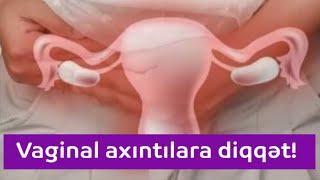 Vaginal axıntılar, Vaginal infeksiyalar və müalicəsi