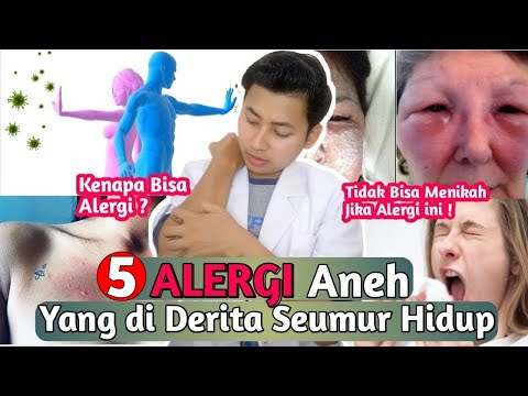 Video: 5 Reaksi Alergi Yang Paling Tidak Biasa