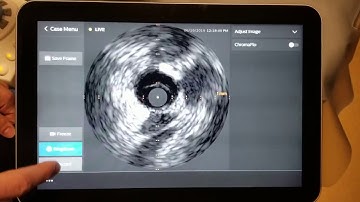 IntraSight is Seamless