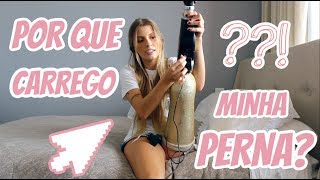 Pernas minhas por nas recebendo crostas continuo aleatórias que