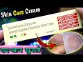 दाद-खाज खुजली Fungal infection, bacterial infection, redness D5 skin cream review // SG Support #SG