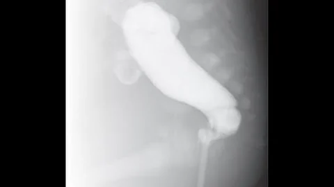 Qual a finalidade da utilização de um contraste negativo ar na realização do enema opaco?
