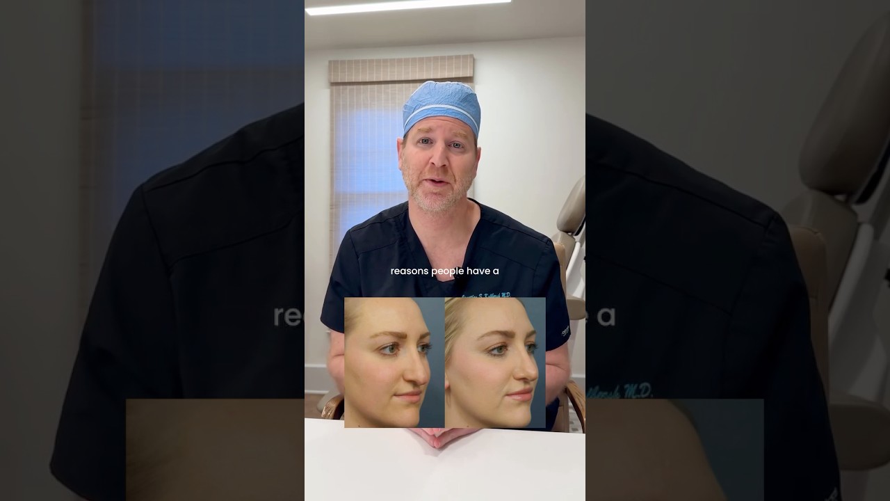 The Top Reason People Get a Rhinoplasty