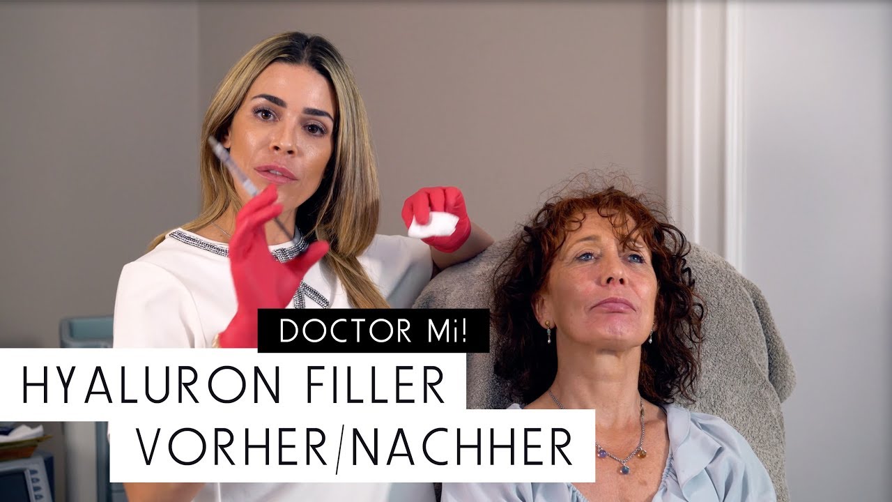 Hyaluron Filler Vorher Nachher Doctor Mi Folge 9 Youtube