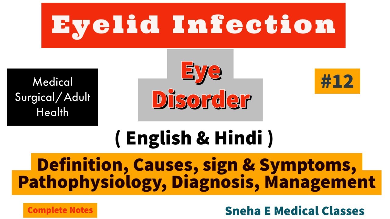 Eye lid Infection !! Hindi !! Eye disorders!! YouTube
