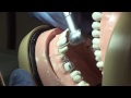 Препарирование зубов под металлокерамические коронки и мостовидные протезы