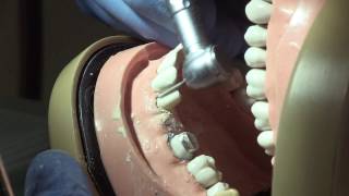 Препарирование зубов под металлокерамические коронки и мостовидные протезы