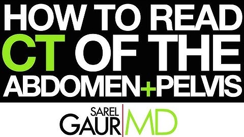 How to read CT of the Abdomen and Pelvis