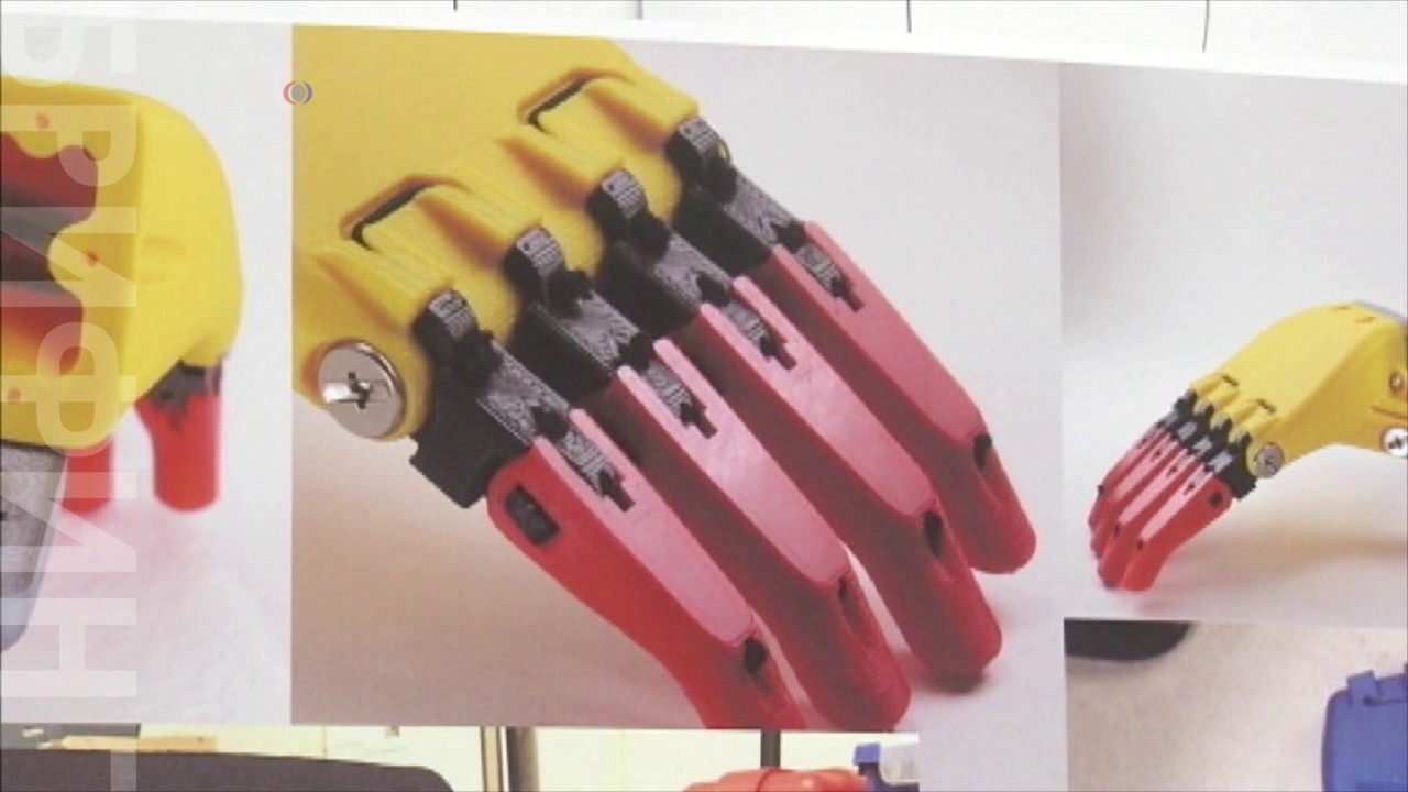 Новый протез от школьников