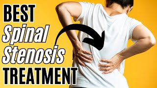 Best Spinal Stenosis Treatment by Dr Todd Sullivan 312 views 2 months ago 9 minutes, 50 seconds