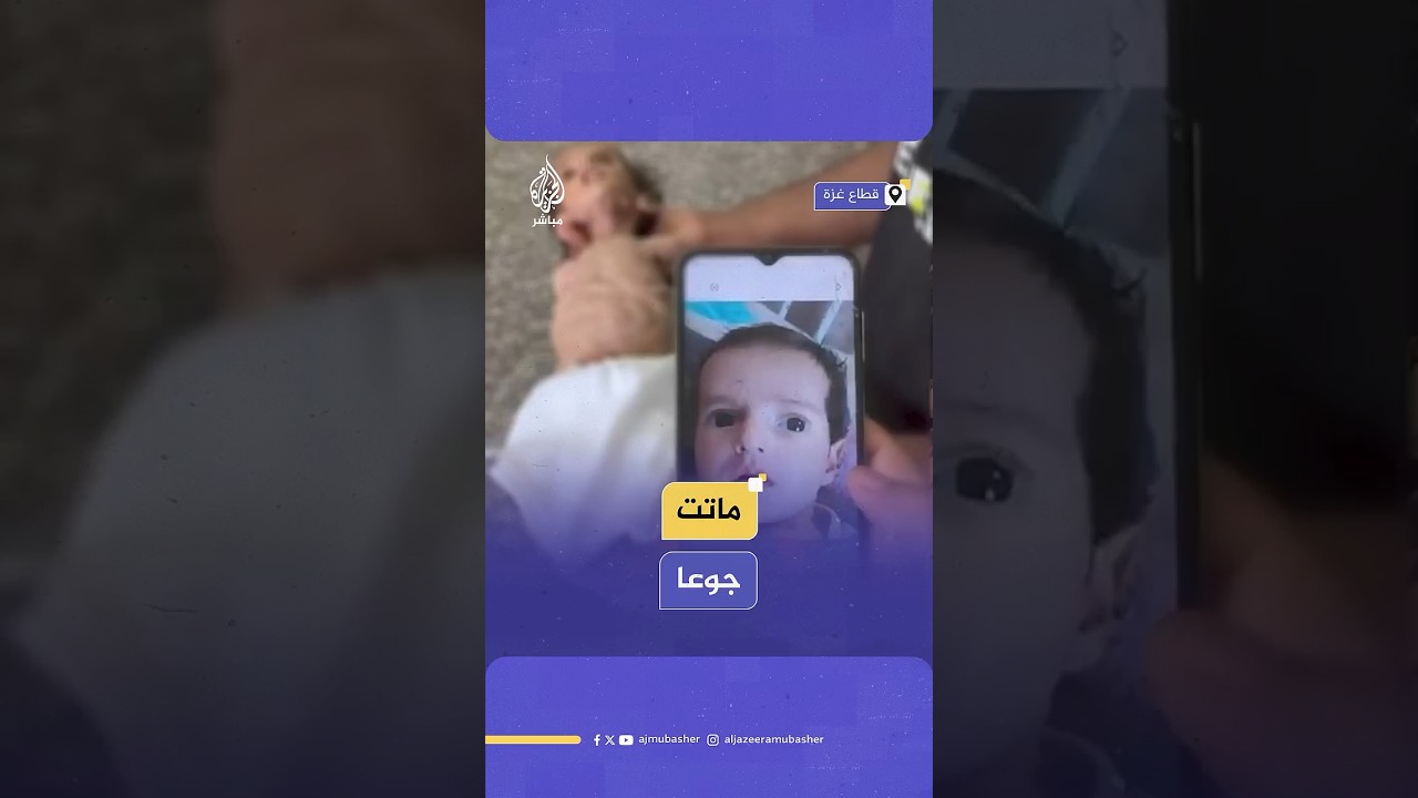 عانت سوء تغذية حادا.. الطفلة الفلسطينية جوري المصري تفارق الحياة جوعا