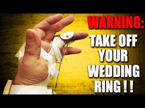 The HARD lesson I learned about wedding rings