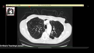 FRCR VIVA CASES RADIOLOGY MADE EASY-DKT MASTERCLASS PART-2