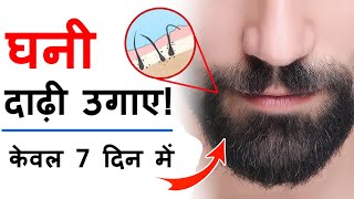 सिर्फ दिन मे 2 बार लगा लो घनी दाढ़ी 7 दिन मे | How to beard grow faster .