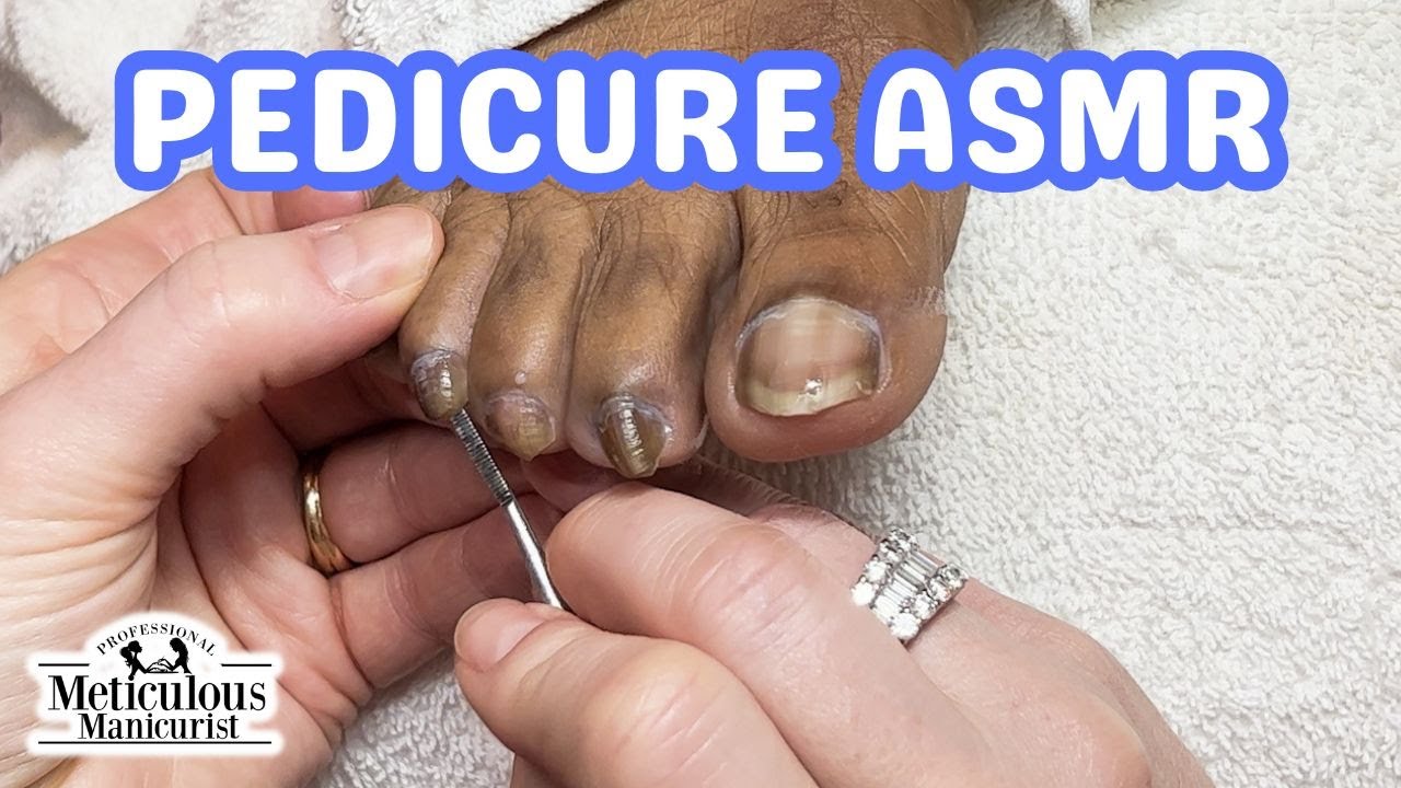 👣ASMR Pedicure Cleaning💆‍♀️Twisting, Turning, and Curling Toenails ...
