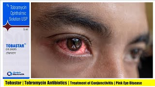 Tobastar Eye/Ear Drops 5 ml | Tobramycin | Aminoglycoside Antibiotic | Treatment of Conjunctivitis