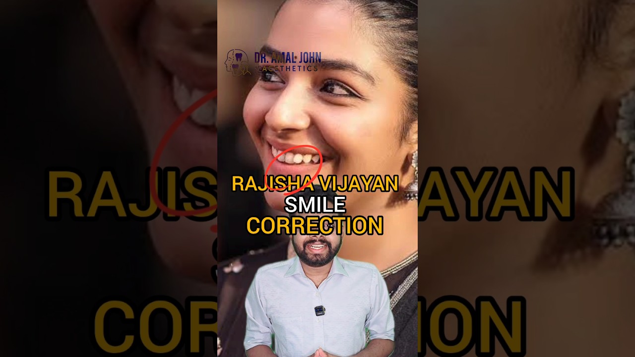 Раджиша Виджаян, коррекция улыбки 
