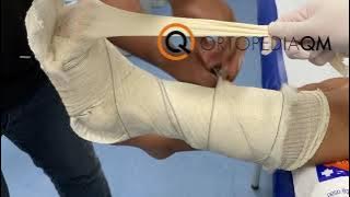 Plaster Splint (Boot), How to make it?
