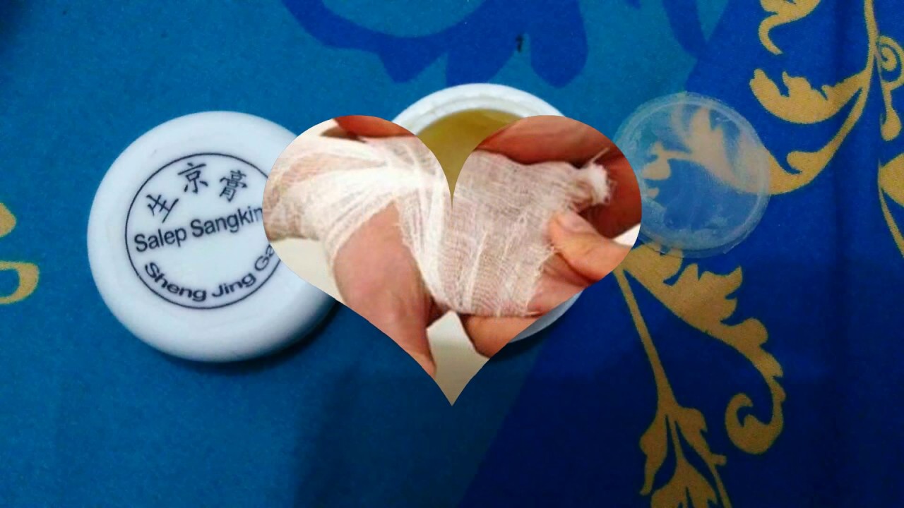 0822 9939 6253 Jual Obat herbal sembuhkan Segala jenis Penyakit kulit