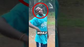 His Elbow Popped Out Then He Did This