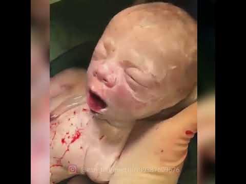 فيديو: كيف يولد أطفال ميتون؟