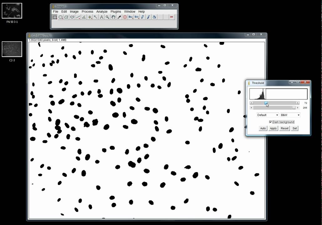 How To Count Cells Using Imagej