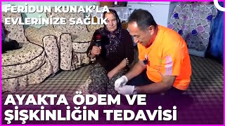 Ayakta Oluşan Ödemin Zararları Nelerdir? Dr Feridun Kunakla Evlerinize Sağlık