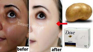 Potatoes and soap,A japanese secret to whitening the skin 10 shades and removing pigmentation screenshot 4