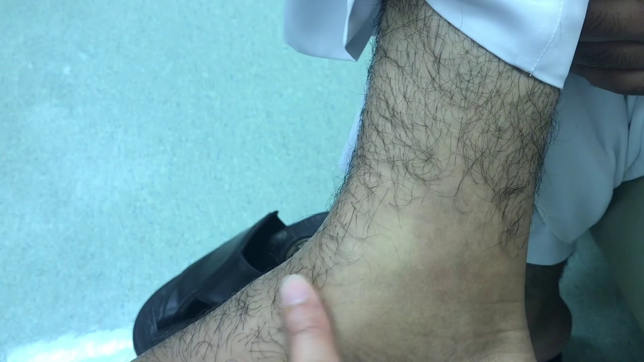 Osteoid Osteoma Treatment in Pakistan image compressor