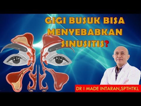 Video: Apakah metadon menyebabkan gigi membusuk?