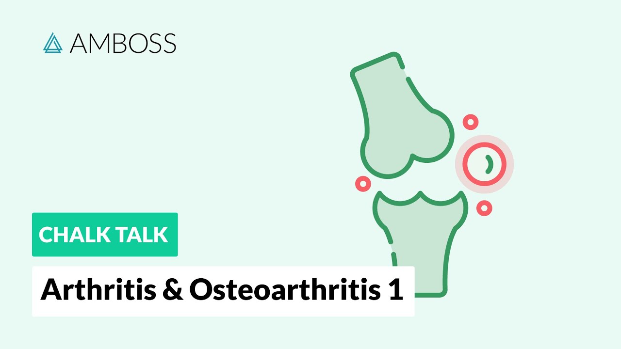 Az osteoarthritis só közös kezelése, Discovery az osteoarthritis kezelésében