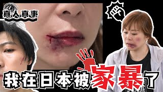 Download Lagu 【警世】我在日本被家暴了｜真相終於都要講出嚟｜真人真事｜JOY TV MP3